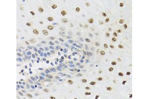 Immunohistochemistry of paraffin-embedded Human esophagus using YTHDF3 Polyclonal Antibody at dilution of 1:100 (40x lens).