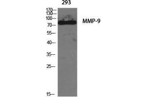 Western Blot (WB) analysis of specific cells using MMP-9 Polyclonal Antibody. (MMP 9 anticorps  (C-Term))