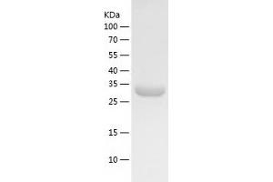 Western Blotting (WB) image for Annexin A13 (ANXA13) (AA 1-316) protein (His-IF2DI Tag) (ABIN7121845)