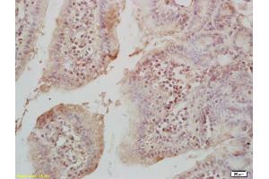 Formalin-fixed and paraffin embedded mouse intestine labeled with Rabbit Anti Acetyl-Histone H4(K16) Polyclonal Antibody, Unconjugated (ABIN1387532) at 1:200 followed by conjugation to the secondary antibody and DAB staining