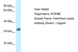 Host: Rabbit Target Name: PITPNB Sample Type: Fetal Brain lysates Antibody Dilution: 1. (PITPNB anticorps  (N-Term))