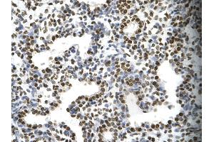 Rabbit Anti-FOSL1 Antibody Catalog Number: ARP31377  Paraffin Embedded Tissue: Human alveolar cell  Cellular Data: Epithelial cells of renal tubule Antibody Concentration:  4.