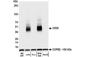 Western Blotting (WB) image for anti-CD28 (CD28) (AA 170-220) antibody (ABIN7455122) (Recombinant CD28 anticorps  (AA 170-220))