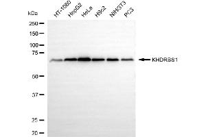 Western blotting analysis using KHDRBS1 antibody (ABIN7799192).