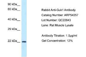 Western Blotting (WB) image for anti-Guanylate Kinase 1 (GUK1) (N-Term) antibody (ABIN2785668) (GUK1 anticorps  (N-Term))