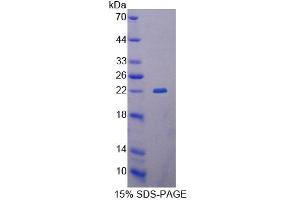 SDS-PAGE analysis of Human GCDH Protein. (GCDH Protéine)