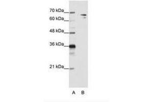 Image no. 2 for anti-Splicing Factor 1 (SF1) (N-Term) antibody (ABIN203234) (Splicing Factor 1 anticorps  (N-Term))