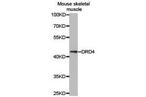 Western Blotting (WB) image for anti-Dopamine Receptor D4 (DRD4) antibody (ABIN1872359)