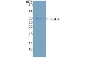 Detection of Recombinant calretinin, Human using Polyclonal Antibody to Calretinin (CR) (Calretinin anticorps  (AA 28-248))