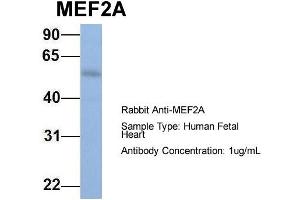 Host: Rabbit Target Name: MEF2A Sample Type: Human Fetal Heart Antibody Dilution: 1. (MEF2A anticorps  (N-Term))