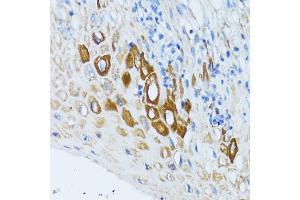 Immunohistochemistry of paraffin-embedded human esophagus using PSRC1 antibody (ABIN5973194) at dilution of 1/100 (40x lens). (PSRC1 anticorps)