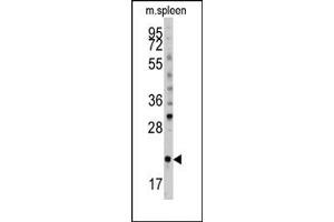Image no. 1 for anti-BH3 Interacting Domain Death Agonist (BID) (pSer61) antibody (ABIN356817)