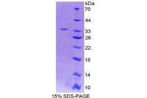 SDS-PAGE (SDS) image for Interleukin 12 beta (IL12B) (AA 35-302) protein (His tag) (ABIN1878752)