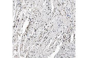 IHC analysis of FOXK1 using anti-FOXK1 antibody (ABIN7600295). (Foxk1 anticorps  (AA 175-671))