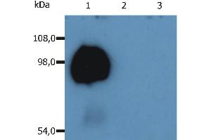 peripheral blood lymphocytes of various species using anti-human CD43 (MEM-59).