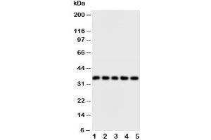 Western blot testing of FosB antibody and Lane 1:  HT1080;  2: SW620;  3: HeLa;  4: SMMC-7721;  5: MM453 cell lysate (FOSB anticorps  (N-Term))