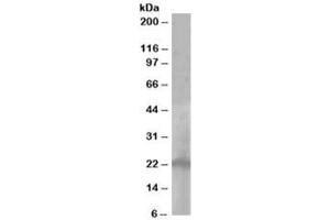 Western blot testing of A431 lysate with PALLID antibody at 1ug/ml. (Pallidin anticorps)