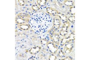 Immunohistochemistry of paraffin-embedded rat kidney using SCG3 antibody. (SCG3 anticorps  (AA 199-468))