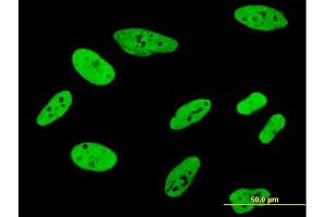 Immunofluorescence of monoclonal antibody to FUBP1 on HeLa cell.