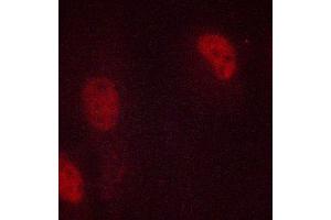 ABIN6267039 staining MCF-7 cells by ICC/IF. (Histone 3 anticorps)