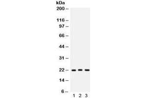 Western blot testing of 1) human A549, 2) rat brain and 3) mouse brain lysate with Peroxiredoxin 5 antibody. (Peroxiredoxin 5 anticorps  (AA 66-198))