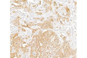 Immunohistochemistry (IHC) image for anti-phosphoglycerate Dehydrogenase (PHGDH) (AA 1-50) antibody (ABIN7455052) (PHGDH anticorps  (AA 1-50))