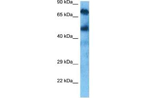 Host:  Rabbit  Target Name:  KCND3  Sample Tissue:  Liver Tumor lysates  Antibody Dilution:  1ug/ml