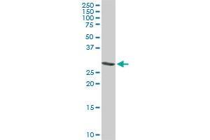 ARPC2 monoclonal antibody (M01), clone 5C8.