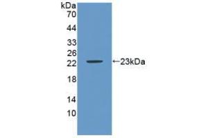 Western blot analysis of recombinant Mouse CA9. (CA9 anticorps  (AA 88-280))