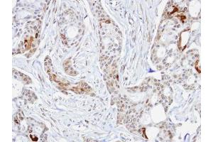IHC-P Image Immunohistochemical analysis of paraffin-embedded Cal27 xenograft, using STIP1, antibody at 1:100 dilution.