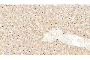 Detection of Hsp60 in Human Liver Tissue using Monoclonal Antibody to Heat Shock Protein 60 (Hsp60)