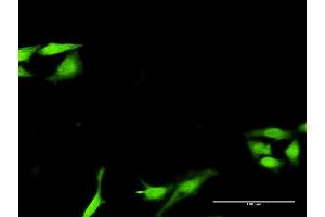 Immunofluorescence of purified MaxPab antibody to SNF8 on HeLa cell. (SNF8 anticorps  (AA 1-258))