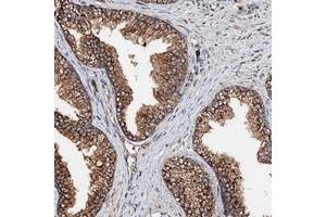 Immunohistochemical staining of human prostate with KIAA0256 polyclonal antibody  shows strong cytoplasmic positivity in glandular cells. (SECISBP2L anticorps)
