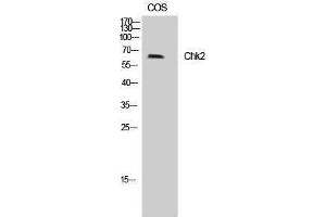 Western Blotting (WB) image for anti-Checkpoint Kinase 2 (CHEK2) (Tyr599) antibody (ABIN3183906) (CHEK2 anticorps  (Tyr599))
