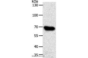 Western blot analysis of HT-29 cell, using ABCG1 Polyclonal Antibody at dilution of 1:500 (ABCG1 anticorps)