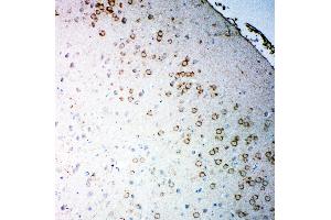 Anti-Muscarinic Acetylcholine Receptor 2 antibody,  IHC(P) IHC(P): Rat Brain Tissue (Muscarinic Acetylcholine Receptor M2 anticorps  (C-Term))