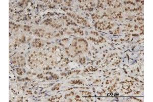 Image no. 1 for anti-Damage Specific DNA Binding Protein 1 (DDB1) (AA 1044-1141) antibody (ABIN599367) (DDB1 anticorps  (AA 1044-1141))