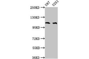 Western Blot Positive WB detected in: U87 whole cell lysate, U251 whole cell lysate All lanes: ABL2 antibody at 4 μg/mL Secondary Goat polyclonal to rabbit IgG at 1/50000 dilution Predicted band size: 129, 125, 127, 115, 118, 116, 117, 61 kDa Observed band size: 115 kDa (ABL2 anticorps  (AA 862-1064))
