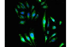 Immunofluorescent analysis of Hela cells using ABIN7154741 at dilution of 1:100 and Alexa Fluor 488-congugated AffiniPure Goat Anti-Rabbit IgG(H+L)