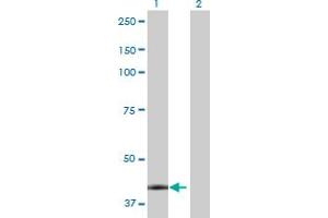 Lane 1: CA12 transfected lysate ( 39.