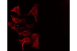 ABIN6275868 staining HuvEc cells by IF/ICC.