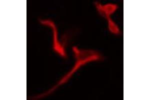 ABIN6274785 staining A549 cells by IF/ICC. (PGD anticorps  (C-Term))