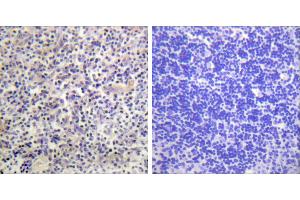 Peptide - +Immunohistochemistry analysis of paraffin-embedded human thyroid gland tissue using HBP1 antibody. (HBP1 anticorps)