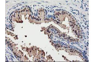 Immunohistochemical staining of paraffin-embedded Human prostate tissue using anti-ACSS2 mouse monoclonal antibody. (ACSS2 anticorps)