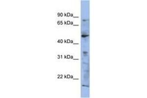 Image no. 1 for anti-RAB3A Interacting Protein (Rabin3) (RAB3IP) (AA 107-156) antibody (ABIN6743739) (RAB3IP anticorps  (AA 107-156))
