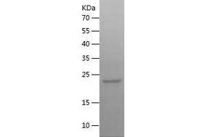 Western Blotting (WB) image for GTPase NRas (NRAS) (AA 1-186) protein (His tag) (ABIN7123231)
