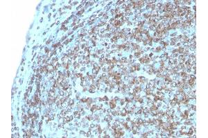 Formalin-fixed, paraffin-embedded human Tonsil stained with CD74 Recombinant Rabbit Monoclonal Antibody (CLIP/3127R). (Recombinant CD74 anticorps)