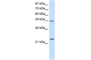 WB Suggested Anti-CBX6 Antibody Titration:  2. (CBX6 anticorps  (N-Term))
