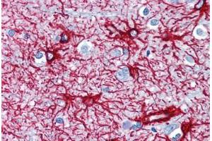 Human Brain, Cortex (formalin-fixed, paraffin-embedded) stained with GFAP antibody ABIN351523 at 1-2 ug/ml followed by biotinylated anti-mouse IgG secondary antibody ABIN481714, alkaline phosphatase-streptavidin and chromogen. (GFAP anticorps)