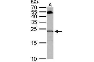 WB Image RGS4 antibody detects RGS4 protein by Western blot analysis.
